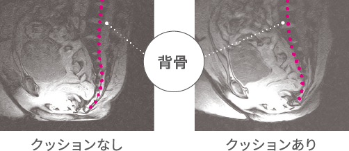 背骨 クッションあり クッションなし