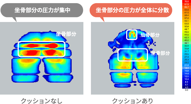 坐骨部分の圧力が集中 坐骨部分の圧力が全体に分散 クッションあり クッションなし