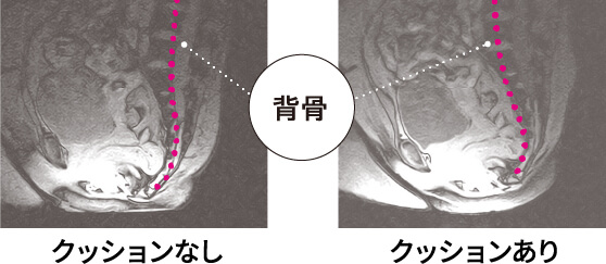 背骨 クッションあり クッションなし