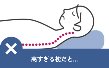 高すぎる枕だと首が前屈気味になる