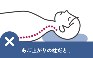 あご上がりの枕だと顎が上がって口が開く
