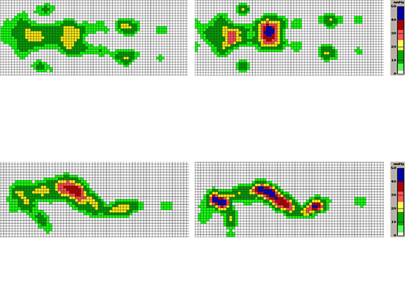 体圧分布比較画像1
